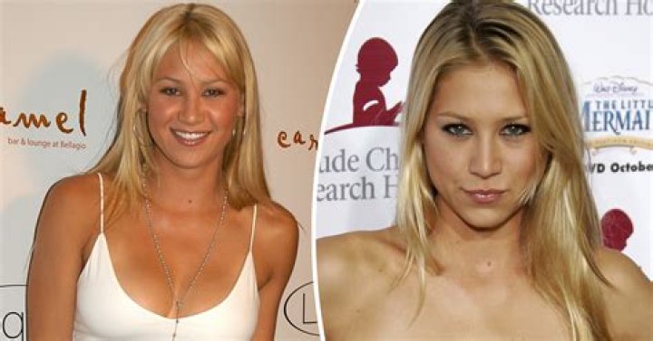 Anna Kournikova Net Worth | Celebrity Net Worth