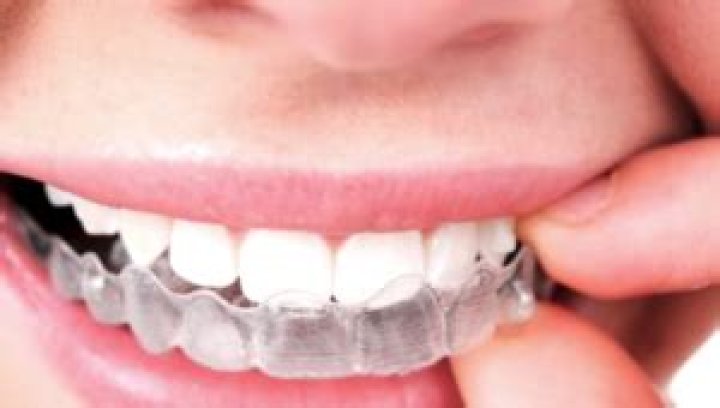 Coffee Heir Makes Billions With Early Bet On Invisalign